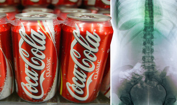 What-Happens-in-Your-Body-After-Drinking-a-Can-of-Coke-1