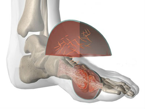 10-Easy-To-Incorporate-Lifestyle-And-Diet-Changes-To-Control-Uric-Acid-Levels-In-Blood-1