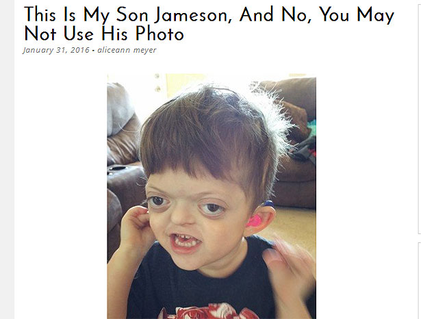 Mother-Defends-Her-Son-After-a-Cruel-Meme-of-His-Photo-Went-Viral-3