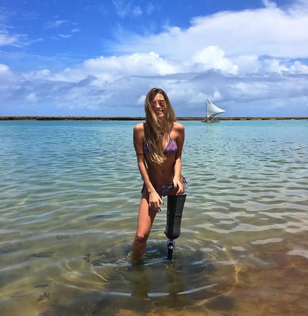 This-21-Year-Old-Model-Proudly-Shows-Her-Prosthetic-Limb-In-Bikini-13