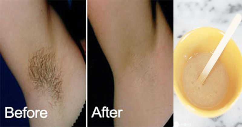 Remove-Your-Underarm-Hairs-In-Just-a-Few-Minutes-1
