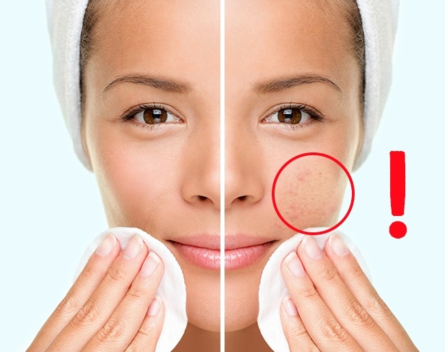 5987305-7-1470920869-650-24b565bbd3-1-1471166258