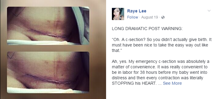 mothers-honest-open-letter-everyone-shamed-c-section-1