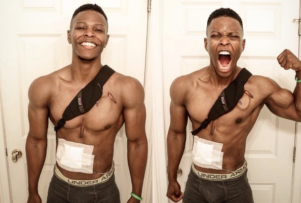 inspiring-fitness-model-that-lives-without-a-working-heart-1