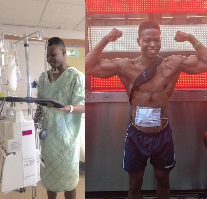 inspiring-fitness-model-that-lives-without-a-working-heart-2