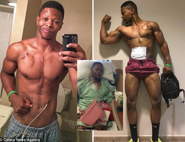 inspiring-fitness-model-that-lives-without-a-working-heart-4