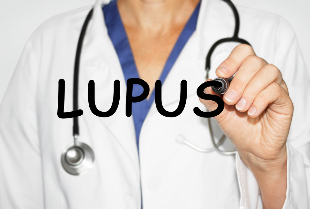 Systematic Lupus Treatment With Herbs And Vitamins Women Daily Magazine