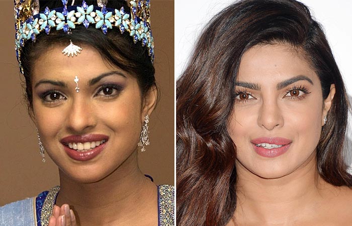 5 Indian Celebrities Who’ve Had Botox (and look GREAT!) - Women Daily