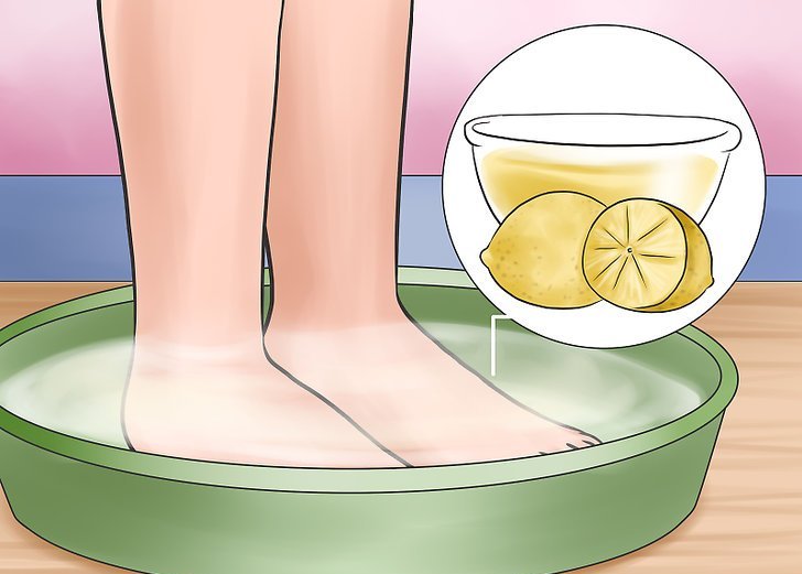 Home Remedies That Will Help You Fight Calluses, Corns and Cracks on