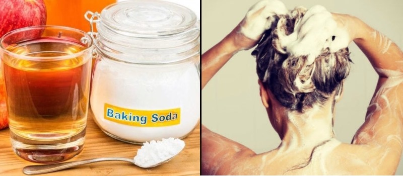3. Baking Soda and Shampoo Treatment - wide 4