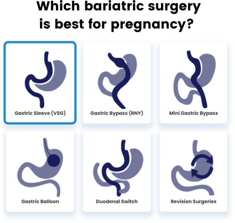 Pregnancy after Bariatric Surgery Women Daily Magazine
