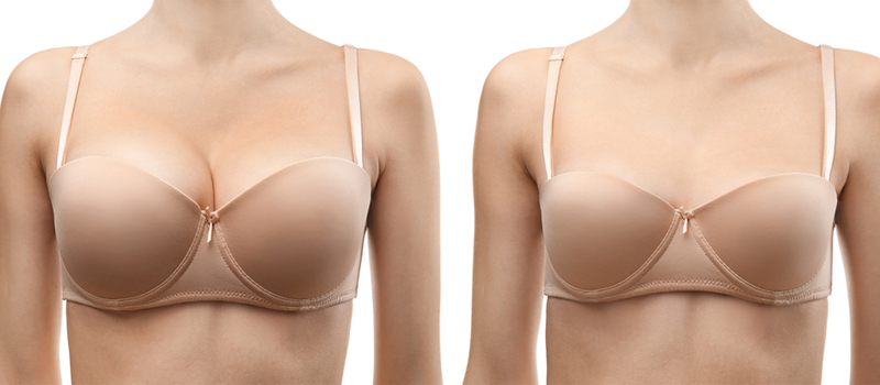 7 Things You Need to Know About Breast Reduction (Pre-surgery)
