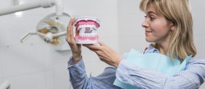 dental implants