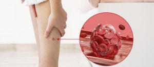 silent vascular disease